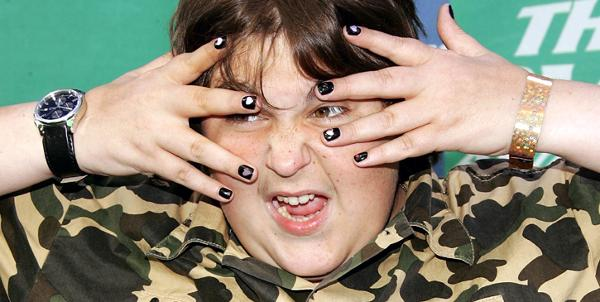 andy milonakis diseases