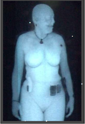 X-ray body scan