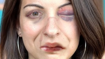 'Beat Up Anita Sarkeesian' Game: Representation of Physical Deterioration Due to Violence
